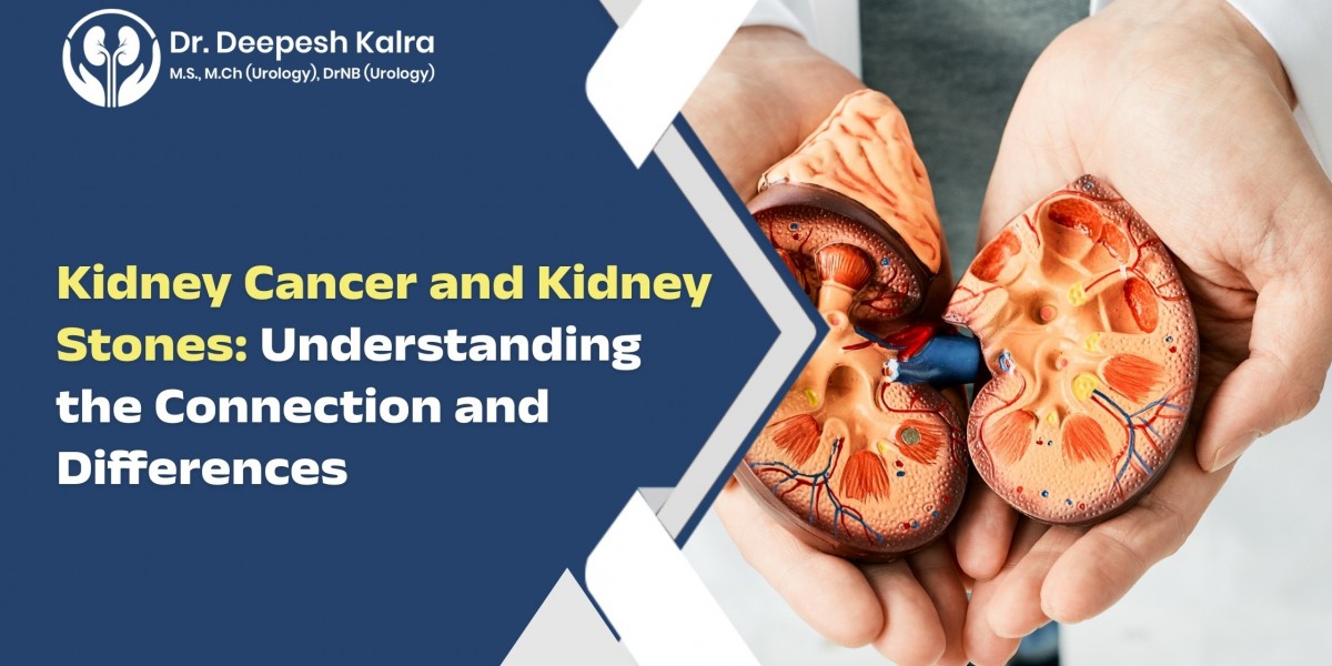 Kidney Cancer vs. Kidney Stones: There Is A Difference - Learn the Facts!