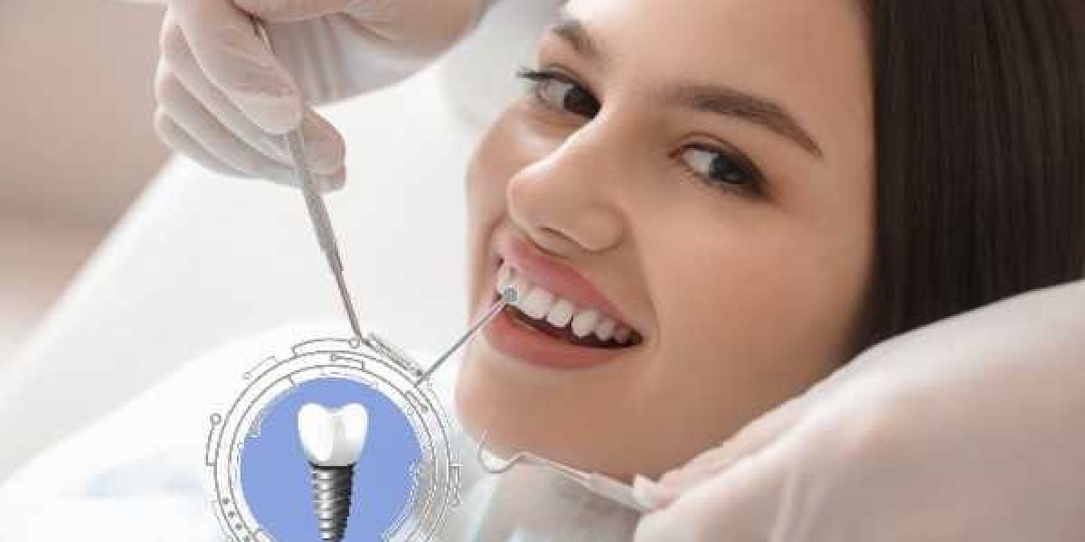 Are Dental Implants Painful? What Patients Really Experience