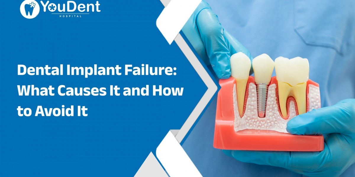 Dental Implant Failure: What Causes It and How to Avoid It