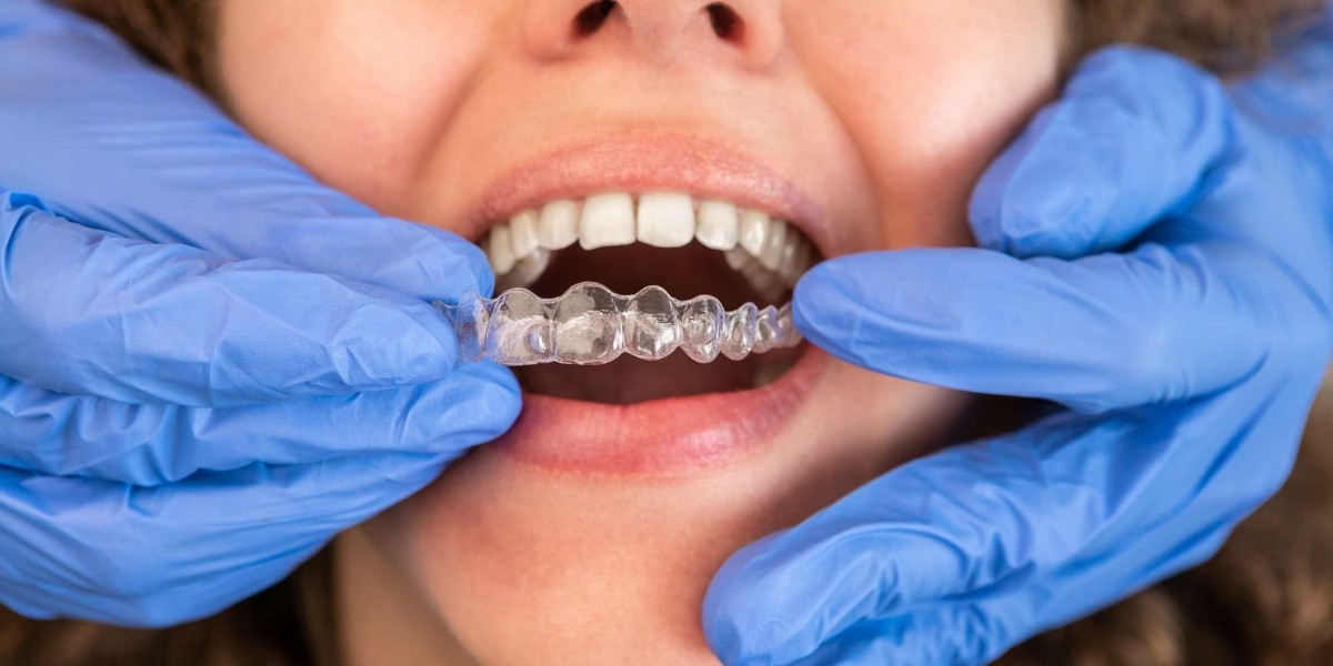 Invisalign for Speech Clarity: Myth or Miracle?