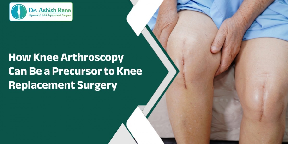 How Knee Arthroscopy Can Be a Precursor to Knee Replacement Surgery