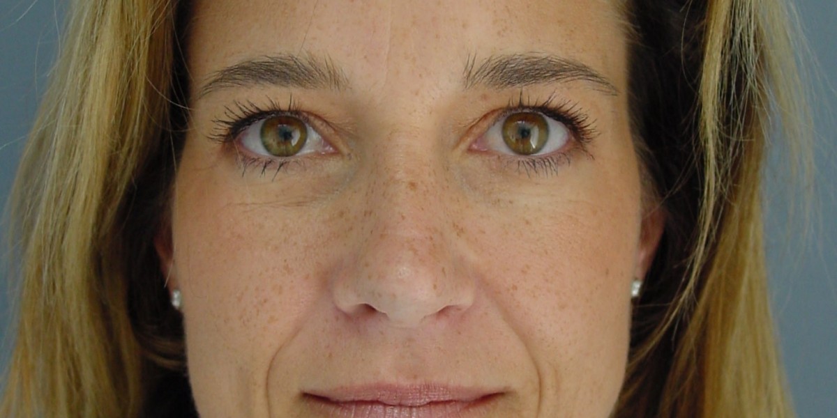 Best Mommy Makeover In Dubai By Dr Frank Conroy