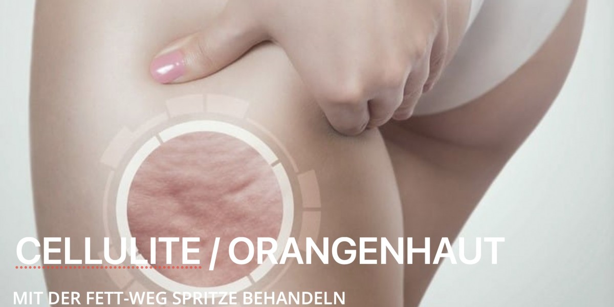 Klinik für Fettreduktion – Modernste Methoden für dauerhaft schlanke Konturen