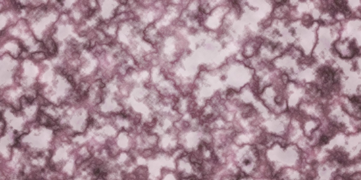 Case Research: The Rise Of Private Jet Leasing Companies